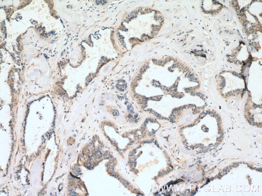 [20895-1-AP-150UL] FBXL15 Polyclonal antibody