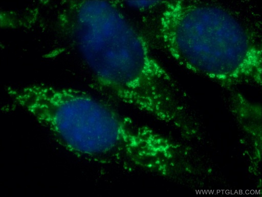 [20899-1-AP-150UL] BRAF Polyclonal antibody