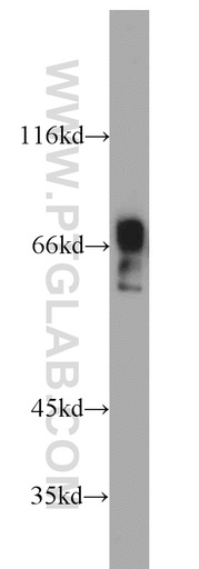 [20900-1-AP-20UL] ZNF496 Polyclonal antibody