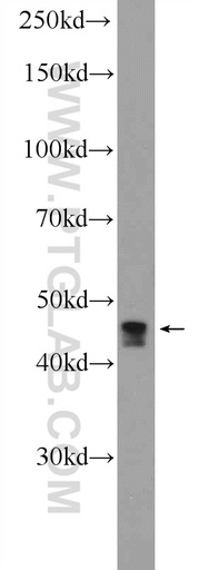 [20902-1-AP-20UL] CCDC83 Polyclonal antibody