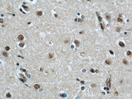 [20904-1-AP-150UL] FAM71E2 Polyclonal antibody