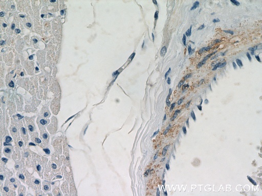 [20916-1-AP-20UL] WDR37 Polyclonal antibody