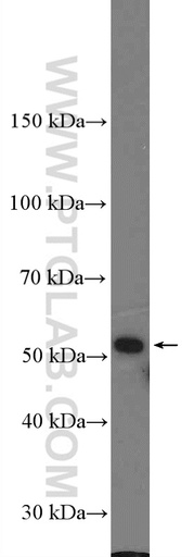 [20918-1-AP-150UL] LRRC17 Polyclonal antibody