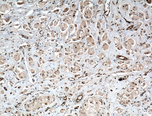 [20920-1-AP-20UL] ITCH Polyclonal antibody