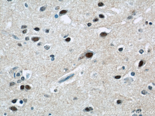[20922-1-AP-20UL] ZNF597 Polyclonal antibody