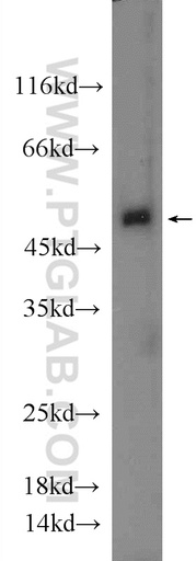 [20931-1-AP-20UL] BEND5 Polyclonal antibody