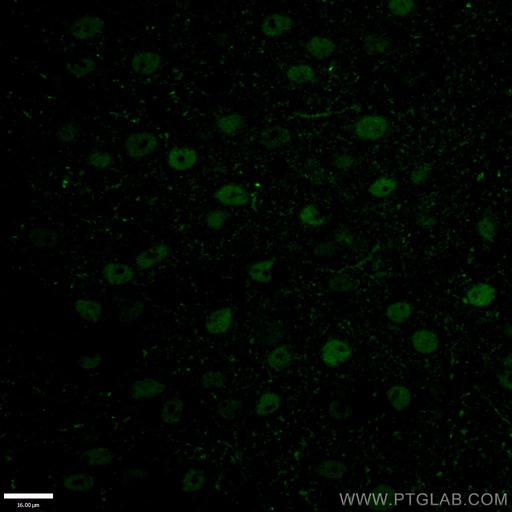 [20932-1-AP-20UL] TBR1 Polyclonal antibody