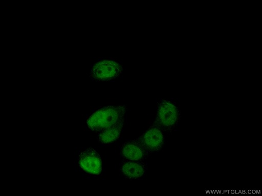 [20933-1-AP-20UL] PHIP Polyclonal antibody