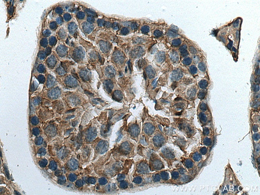 [20936-1-AP-20UL] DPCD Polyclonal antibody