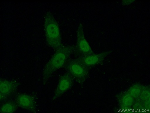 [20940-1-AP-20UL] C1orf83 Polyclonal antibody