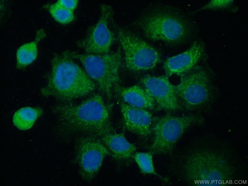 [20941-1-AP-20UL] ACBD4 Polyclonal antibody