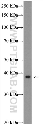 [20943-1-AP-20UL] SAP30BP Polyclonal antibody