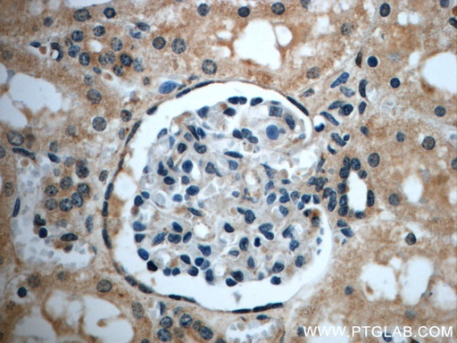 [20944-1-AP-20UL] ZC3HAV1L Polyclonal antibody