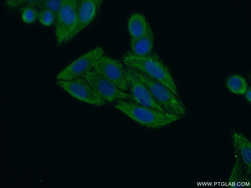 [20945-1-AP-150UL] KIAA1984 Polyclonal antibody