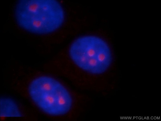 [20952-1-AP-150UL] ABHD14B Polyclonal antibody