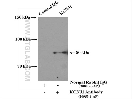 [20953-1-AP-150UL] KCNJ1 Polyclonal antibody