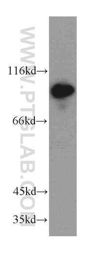 [20956-1-AP-20UL] Advillin Polyclonal antibody