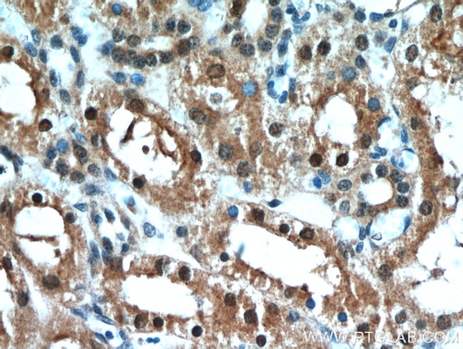 [20957-1-AP-20UL] C1orf50 Polyclonal antibody
