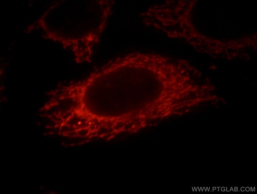 [20959-1-AP-150UL] MRPP3 Polyclonal antibody