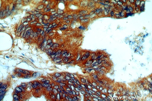 [20962-1-AP-150UL] PYCR1 Polyclonal antibody