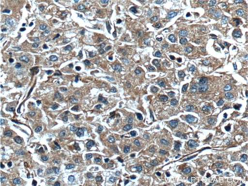 [20963-1-AP-20UL] F5 Polyclonal antibody