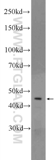 [20967-1-AP-150UL] CRHR1 Polyclonal antibody