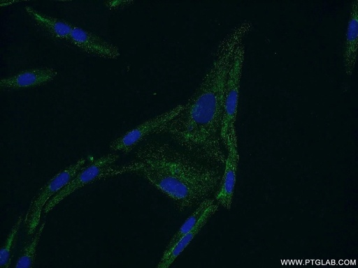 [20968-1-AP-150UL] CYP11B2 Polyclonal antibody