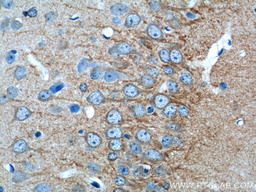 [20969-1-AP-20UL] CACNG2 Polyclonal antibody