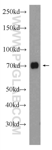 [20981-1-AP-20UL] NR2C2 Polyclonal antibody