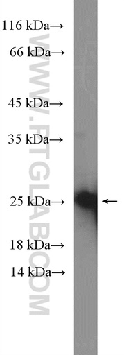 [20990-1-AP-150UL] PIRT Polyclonal antibody
