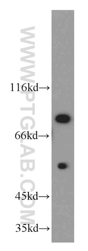 [20992-1-AP-20UL] Cyclin T1 Polyclonal antibody