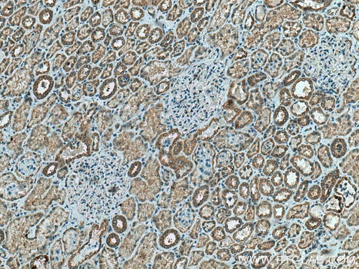 [20997-1-AP-20UL] TMEM61 Polyclonal antibody
