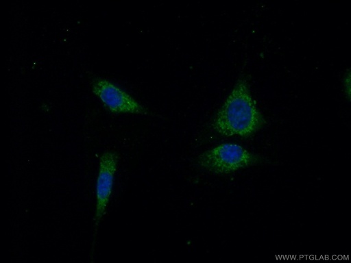 [21002-1-AP-150UL] OTUD5 Polyclonal antibody