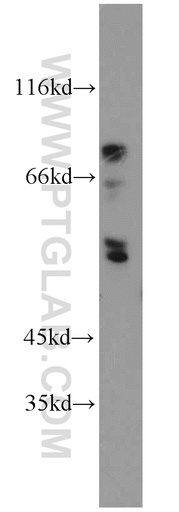[21010-1-AP-20UL] ENTPD8 Polyclonal antibody