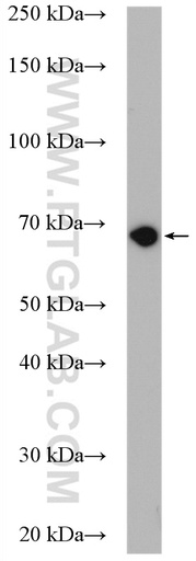 [21011-1-AP-150UL] Alkyl-DHAP synthase/AGPS Polyclonal antibody