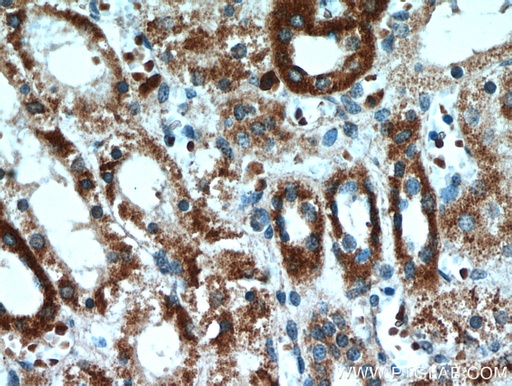 [21013-1-AP-20UL] CLEC18A Polyclonal antibody