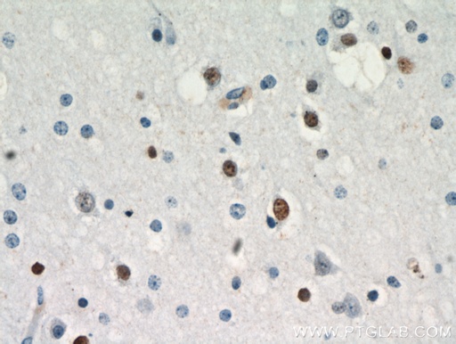 [21014-1-AP-150UL] ZNF488 Polyclonal antibody