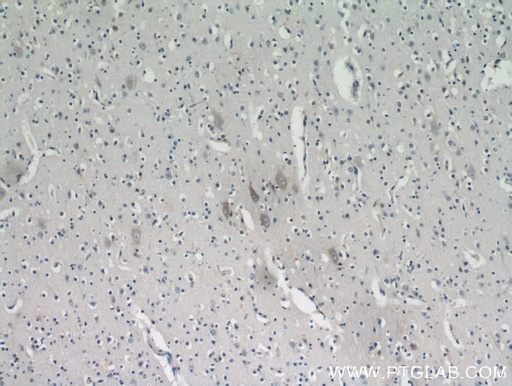 [21016-1-AP-20UL] KIAA0319L Polyclonal antibody