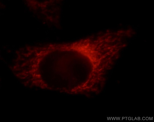 [21021-1-AP-20UL] PDXDC1 Polyclonal antibody
