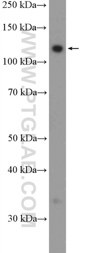 [21022-1-AP-20UL] FAM186B Polyclonal antibody
