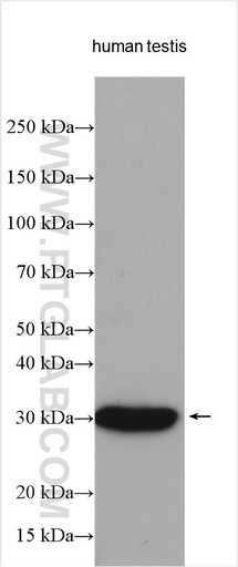 [21023-1-AP-150UL] ANKRD7 Polyclonal antibody
