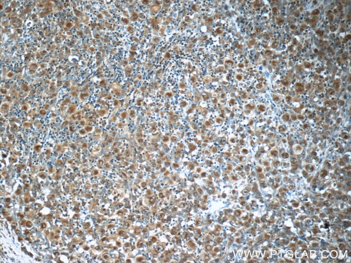 [21028-1-AP-20UL] RNF213 Polyclonal antibody