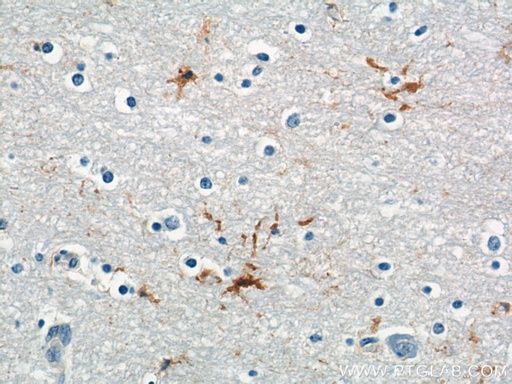 [21029-1-AP-20UL] MAS1L Polyclonal antibody
