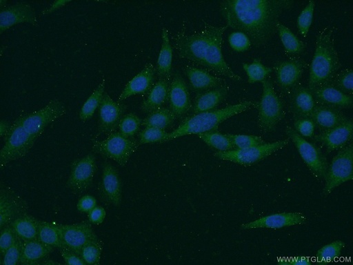 [21031-1-AP-20UL] C1orf92 Polyclonal antibody