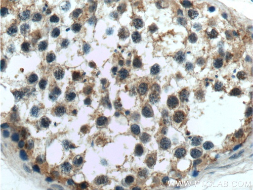 [21036-1-AP-20UL] C9orf98 Polyclonal antibody