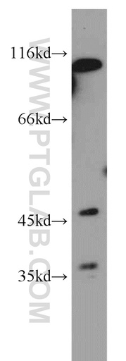 [21037-1-AP-150UL] MFSD7 Polyclonal antibody