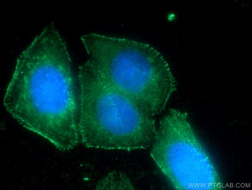 [21038-1-AP-150UL] FAM78A Polyclonal antibody
