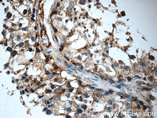 [21040-1-AP-20UL] TMX3 Polyclonal antibody