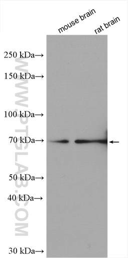 [21043-1-AP-150UL] MED26 Polyclonal antibody