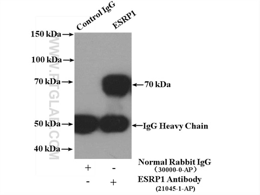 [21045-1-AP-20UL] ESRP1 Polyclonal antibody